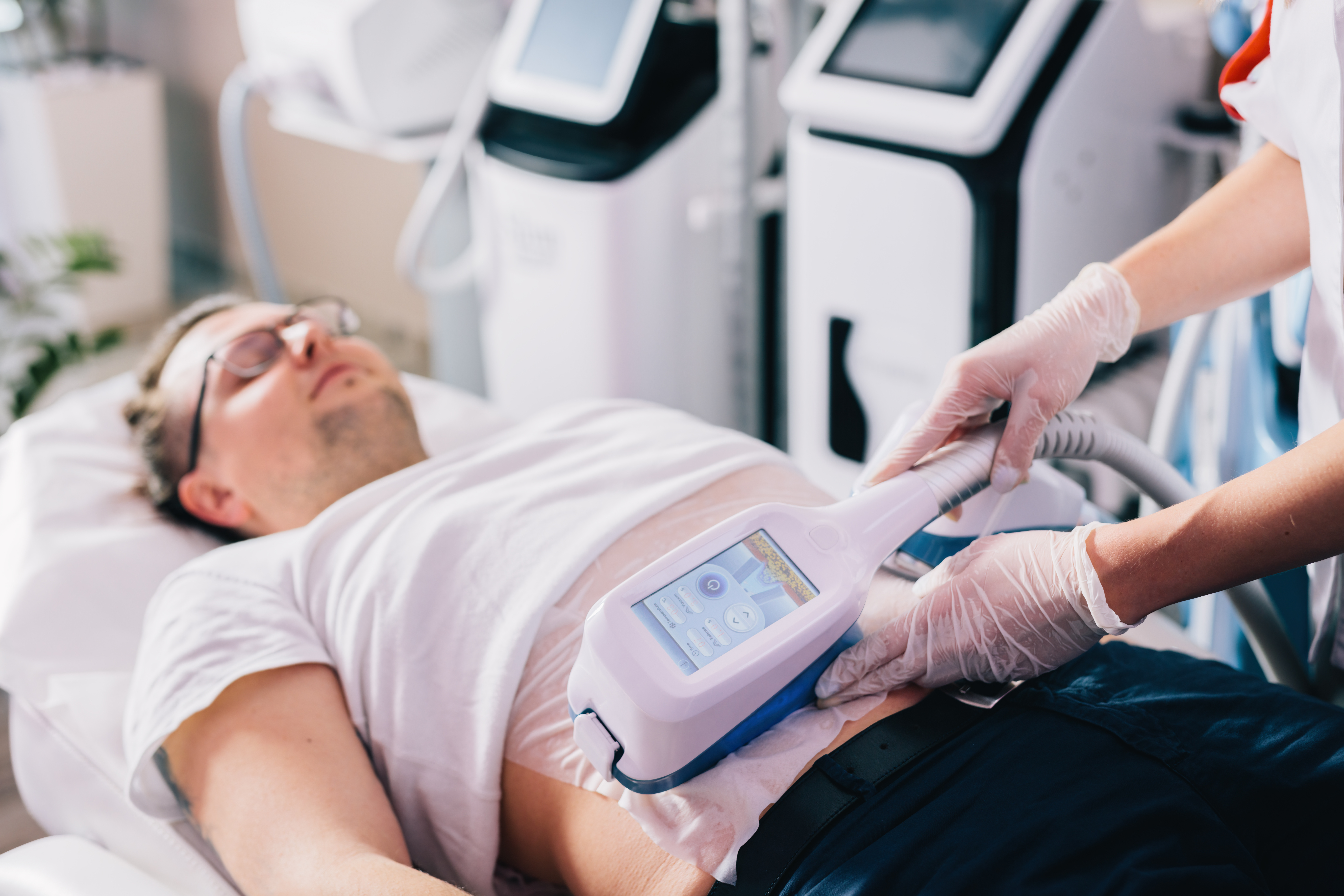 CoolSculpting fat removal treatment on a man's abdomen.
